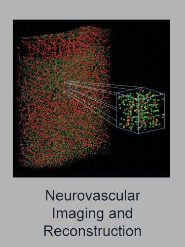 Neurovascular_Imaging_and_Reconstruction
